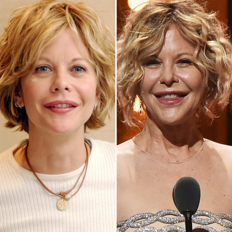 Plastic surgery meg ryan