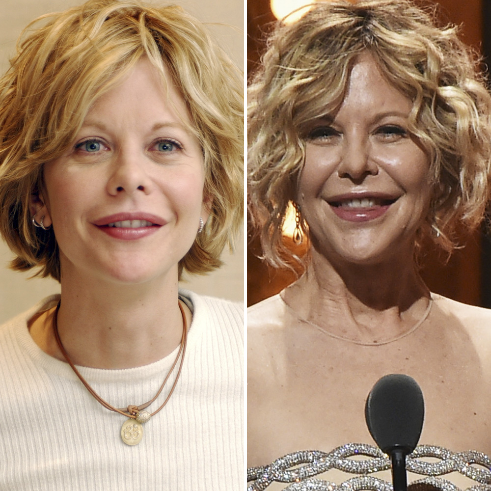 Plastic surgery meg ryan