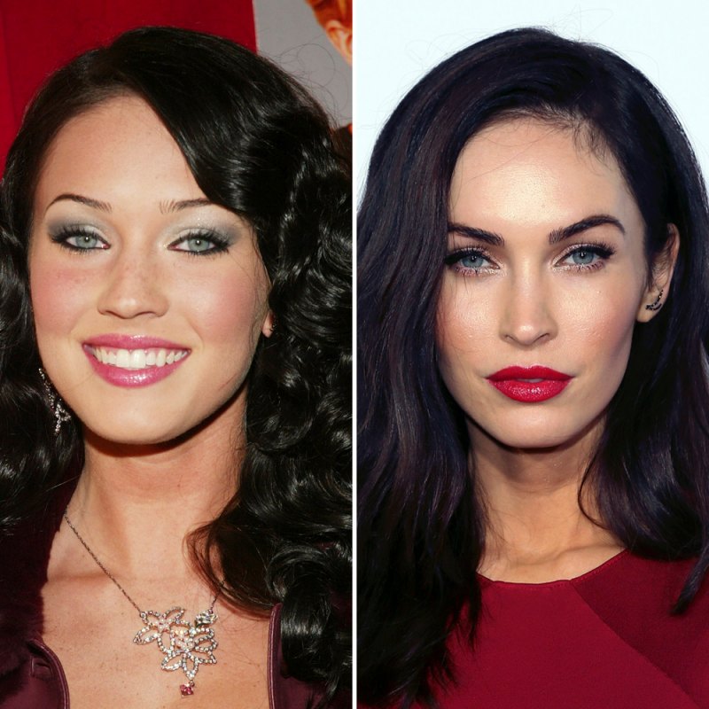 Plastic surgery megan fox