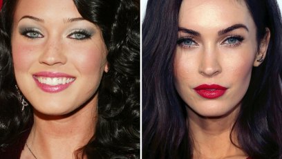Plastic surgery megan fox