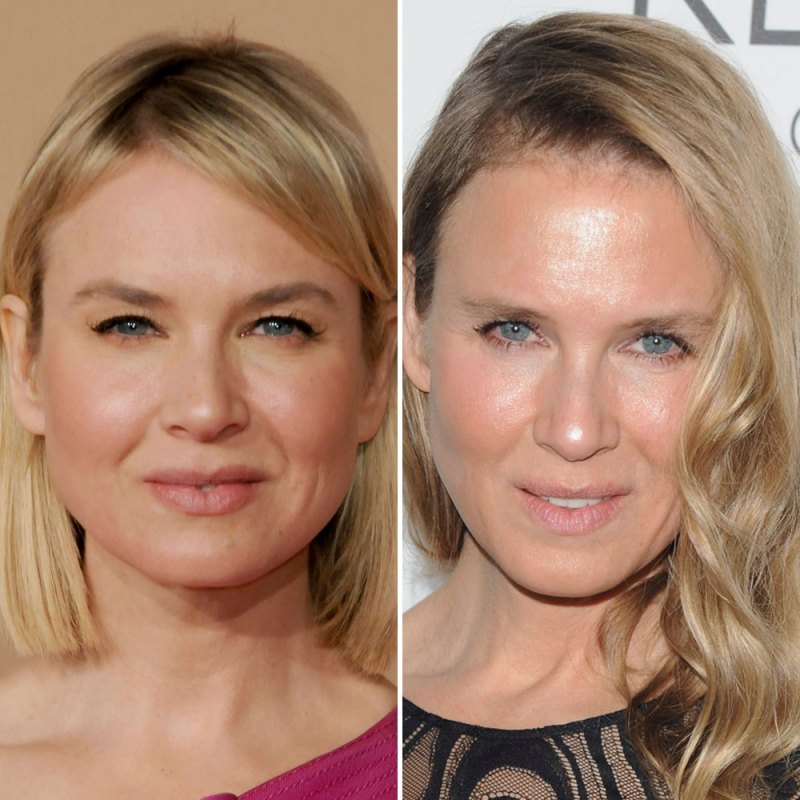 Plastic surgery renee zellweger