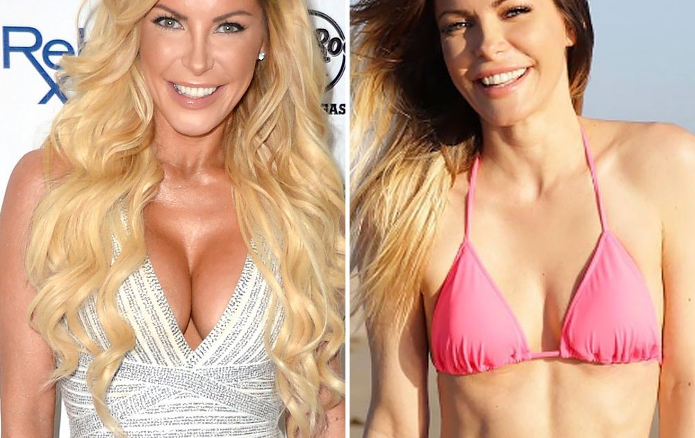 Crystal Hefner, Pamela Anderson, and More Stars Who Had Their