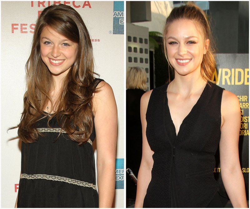 Melissa benoist