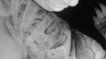 Rob kardashian blac chyna