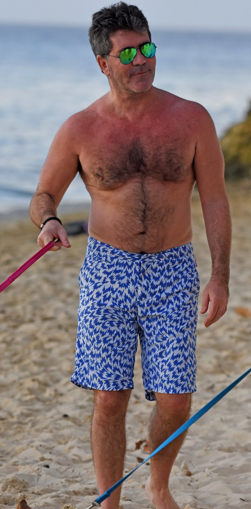 Simon cowell sunburn