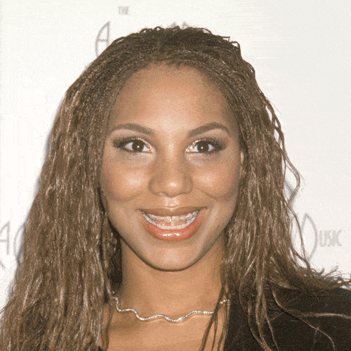 Tamar braxton plastic surgery