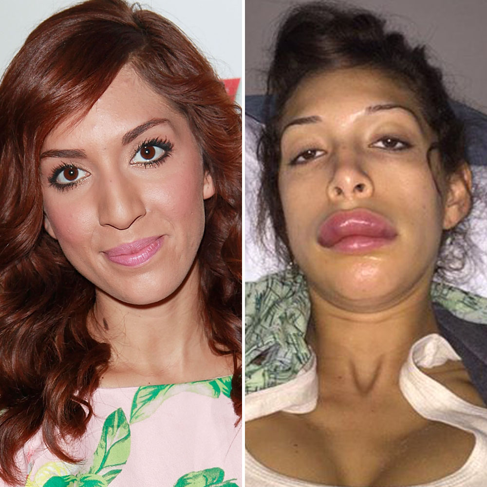 Farrah abraham surgery