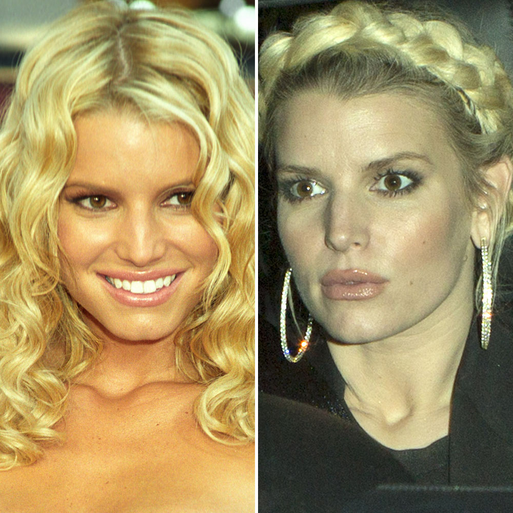 Jessica simpson lips