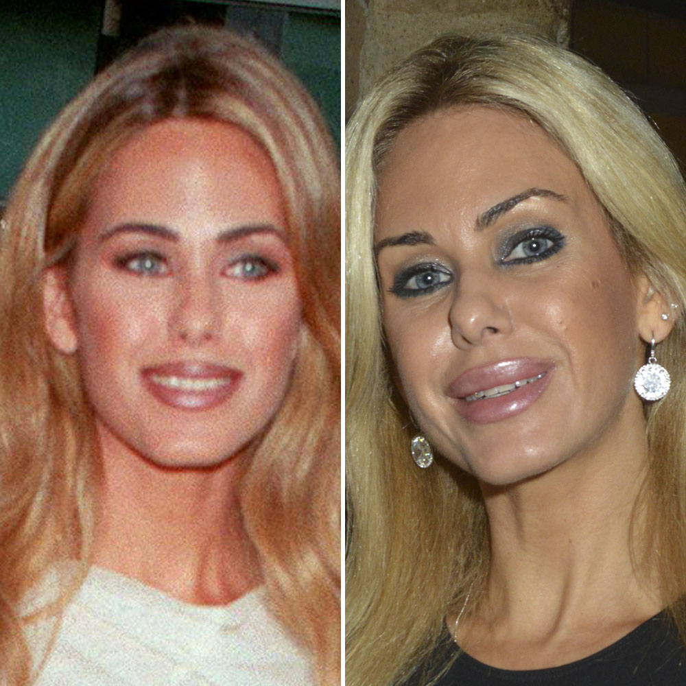 Shauna sand surgery