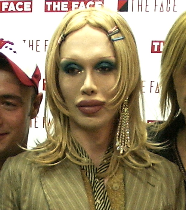 Pete burns 2003