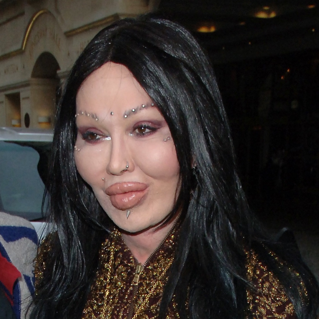 Pete burns 2010