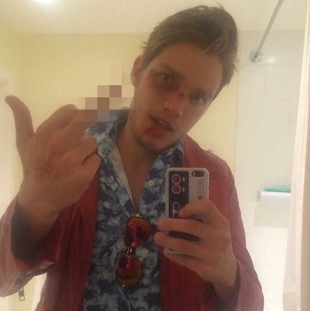 Dominic sherwood halloween