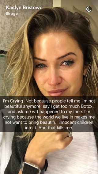 kaitlyn bristowe botox snapchat