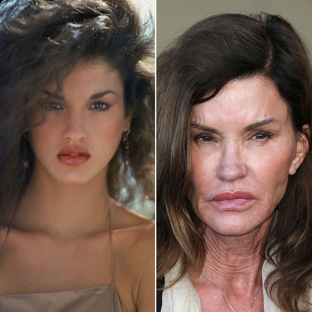 Janice dickinson plastic
