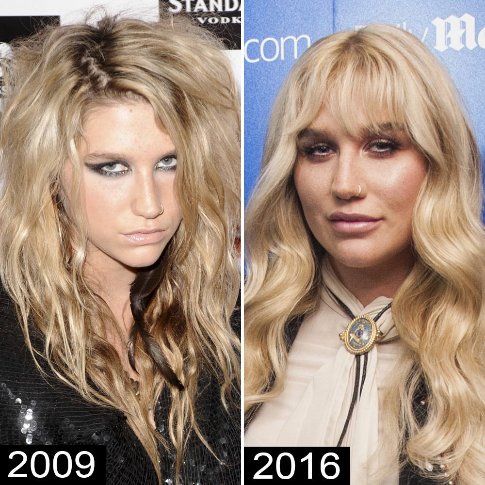 Kesha then now