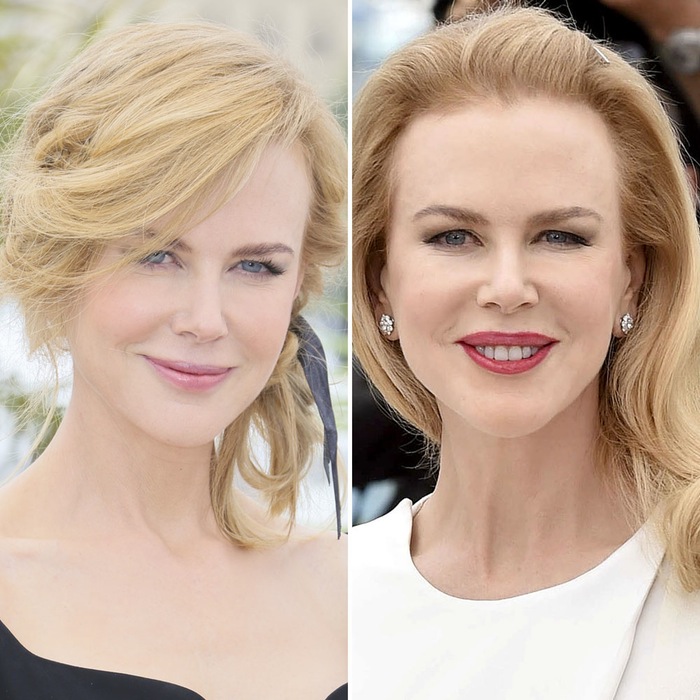 Nicole Kidman Sparks Plastic Surgery Rumors With