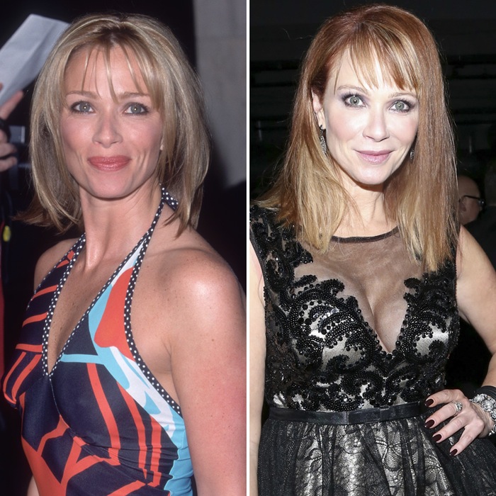 Plastic surgery lauren holly