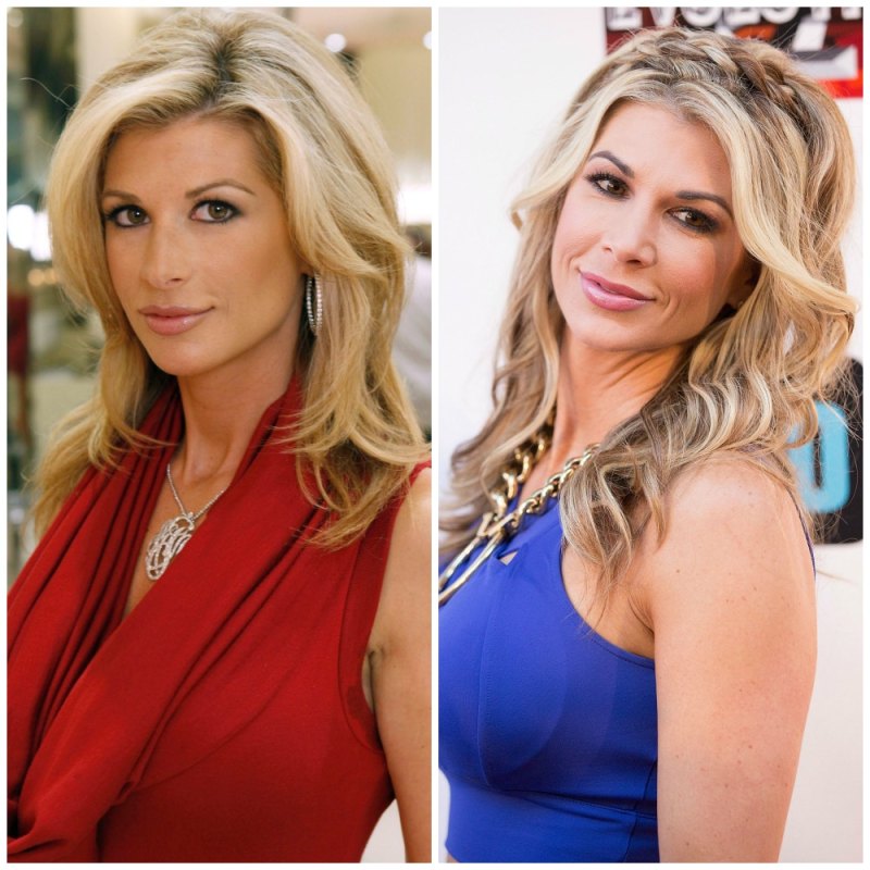 Housewives plastic surgery alexis bellino