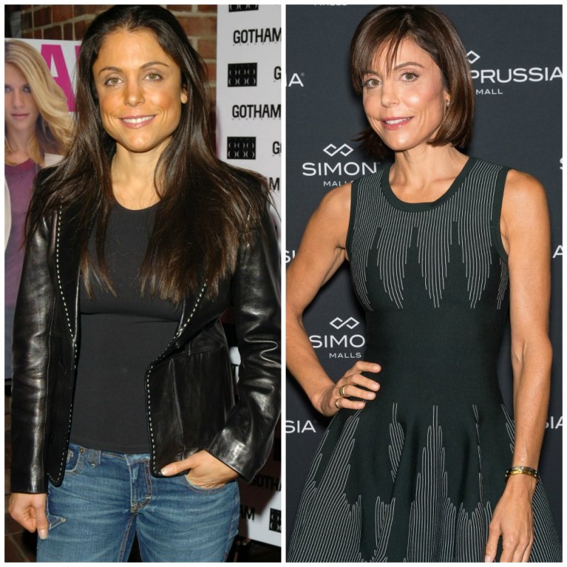 Housewives plastic surgery bethenny frankel