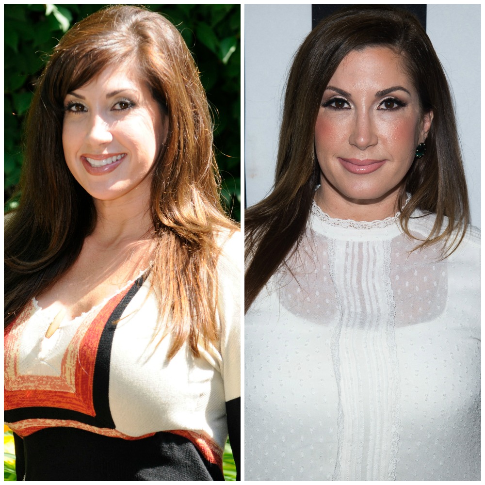 Housewives plastic surgery jaqueline laurita