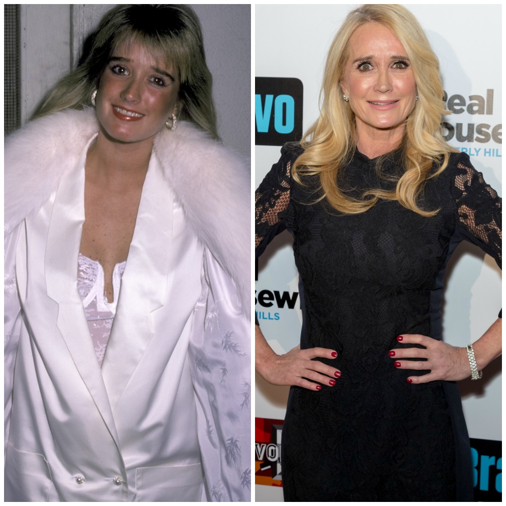 Housewives plastic surgery kim richards