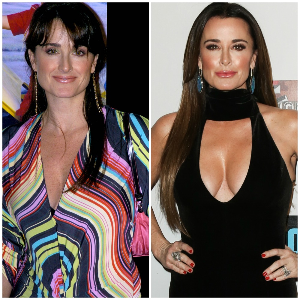 Housewives plastic surgery kyle richards