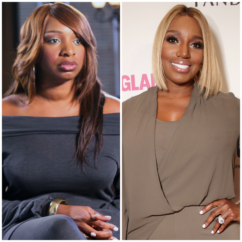 Housewives plastic surgery nene leakes