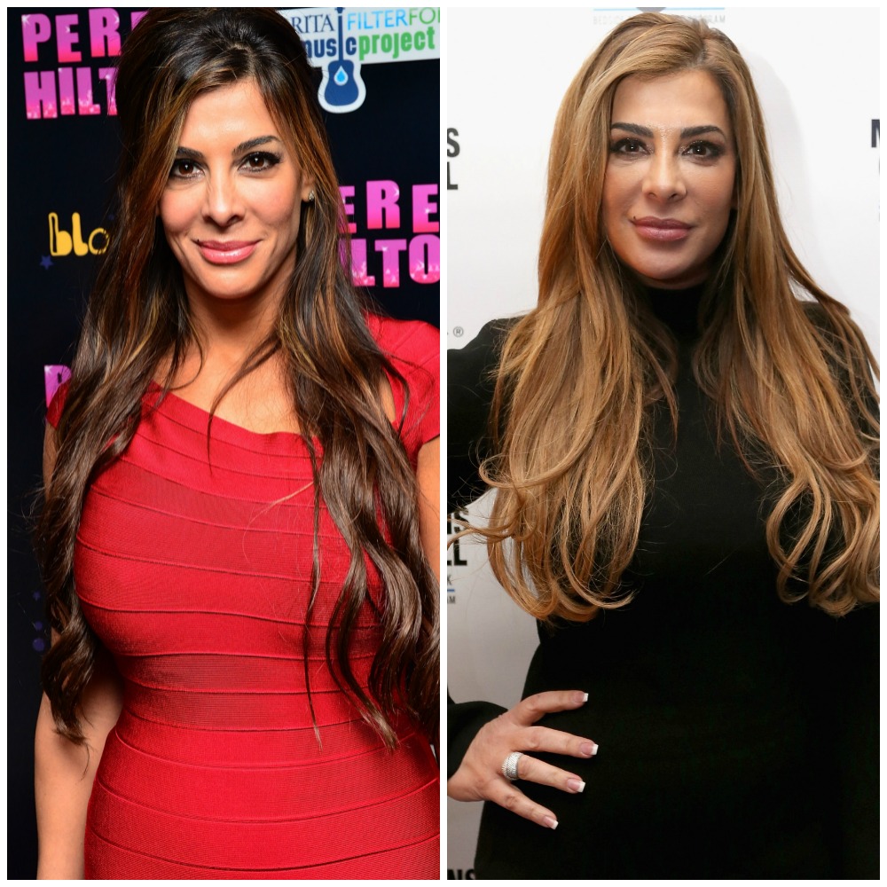 Housewives plastic surgery siggy flicker