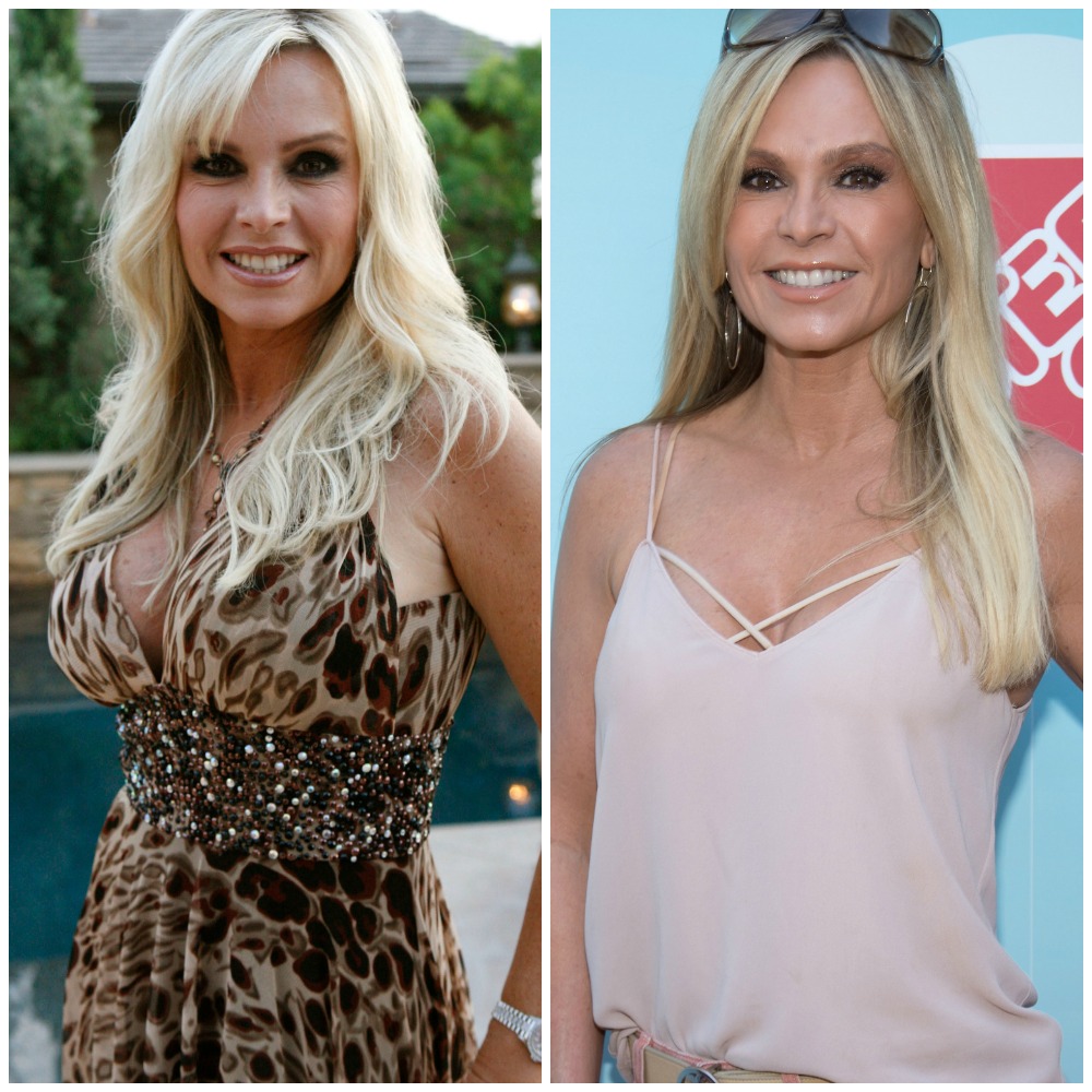 Housewives plastic surgery tamra judge