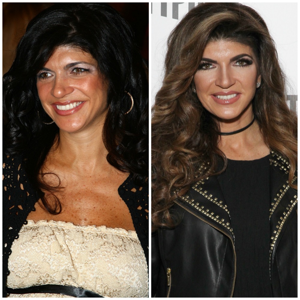 Housewives plastic surgery teresa giudice