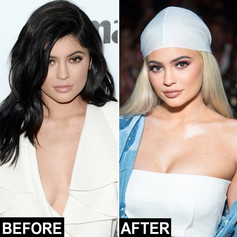 Kylie jenner transformation