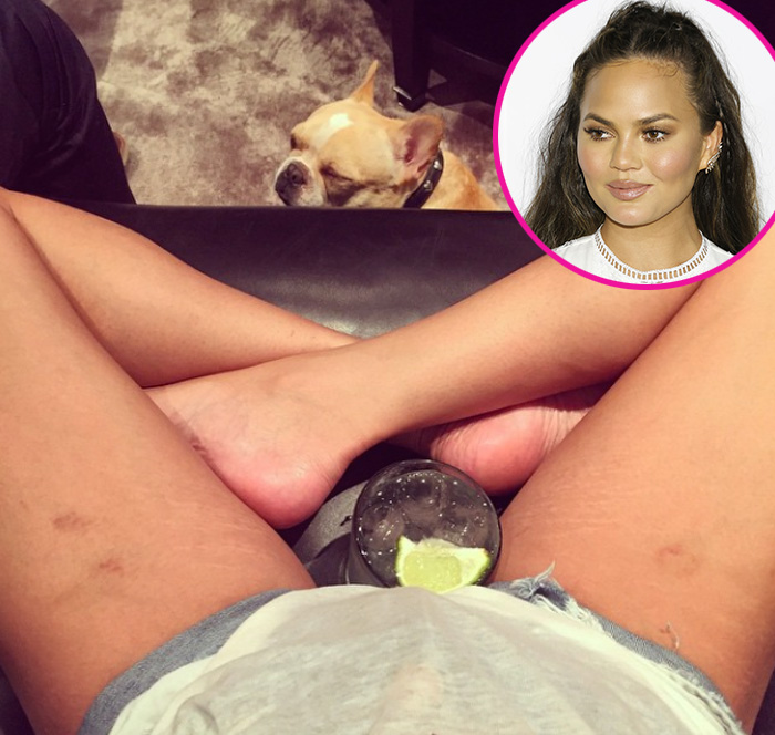 Chrissy teigen stretch marks