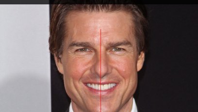 Tom cruise facial flaws