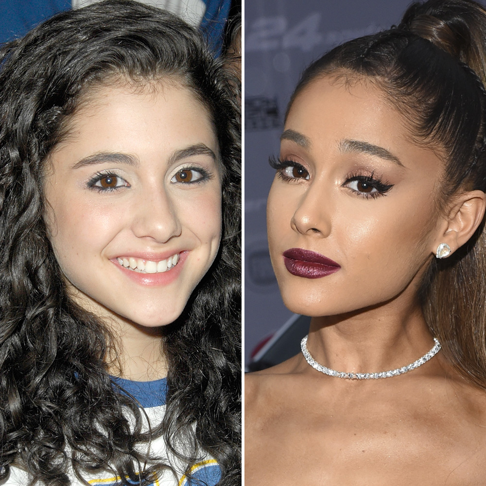 Ariana grande nose job