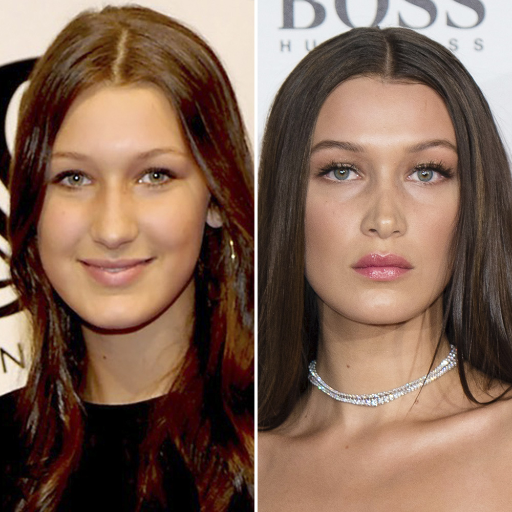 Bella hadid nose job