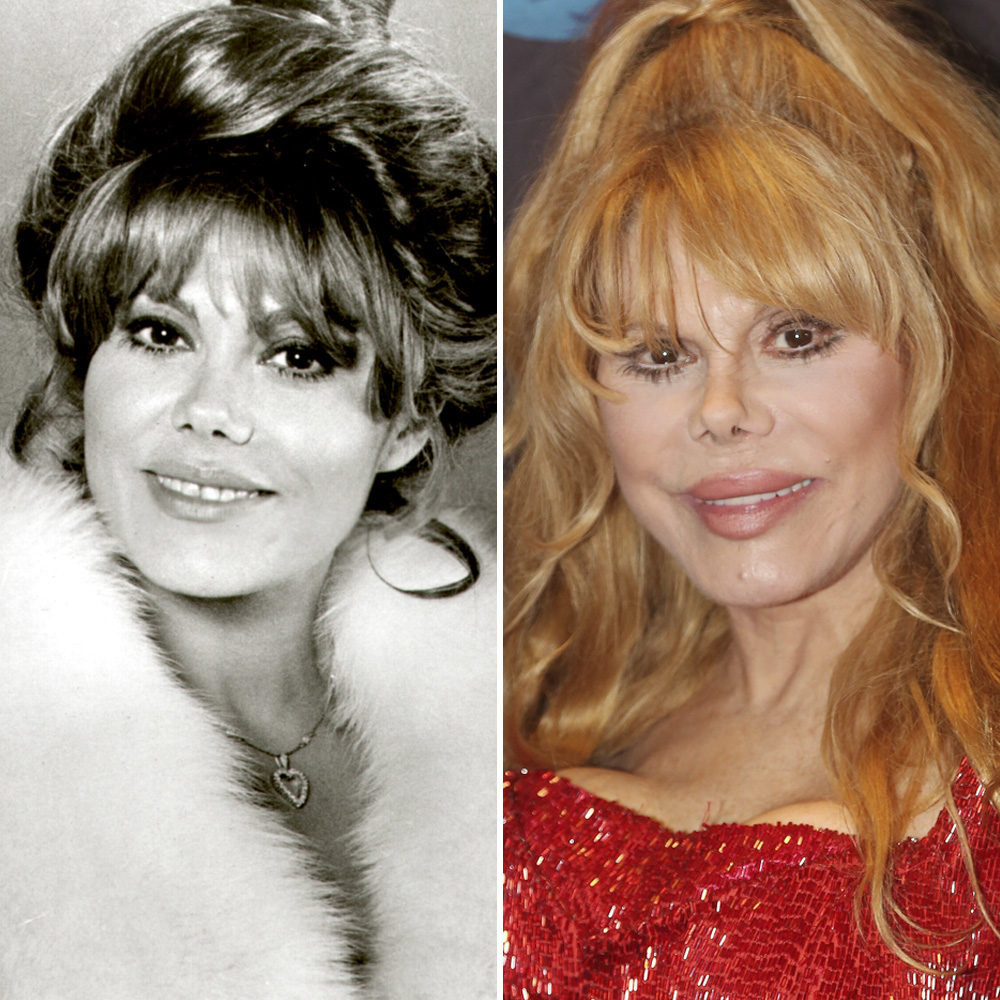 Charo nose job