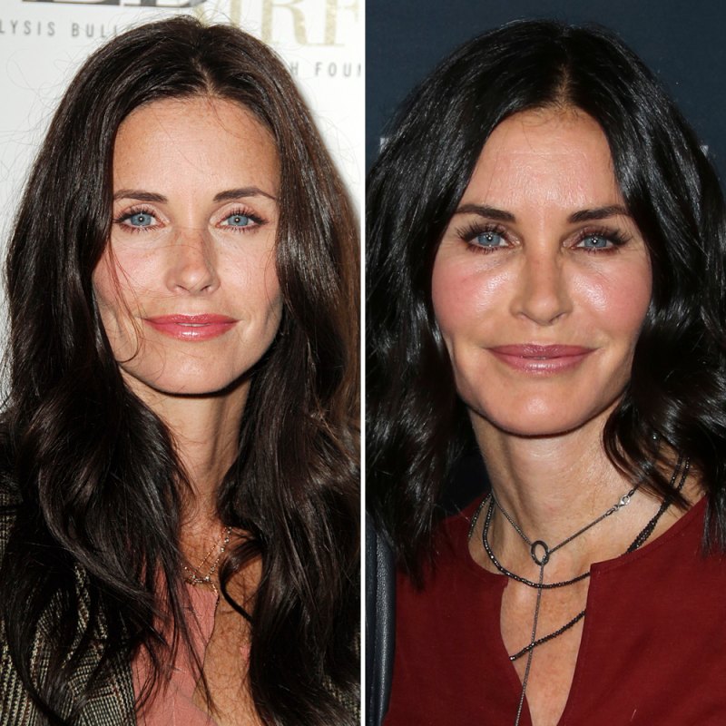 Courteney cox plastic surgery