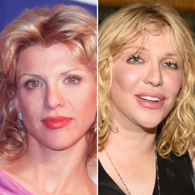 Courtney love plastic surgery