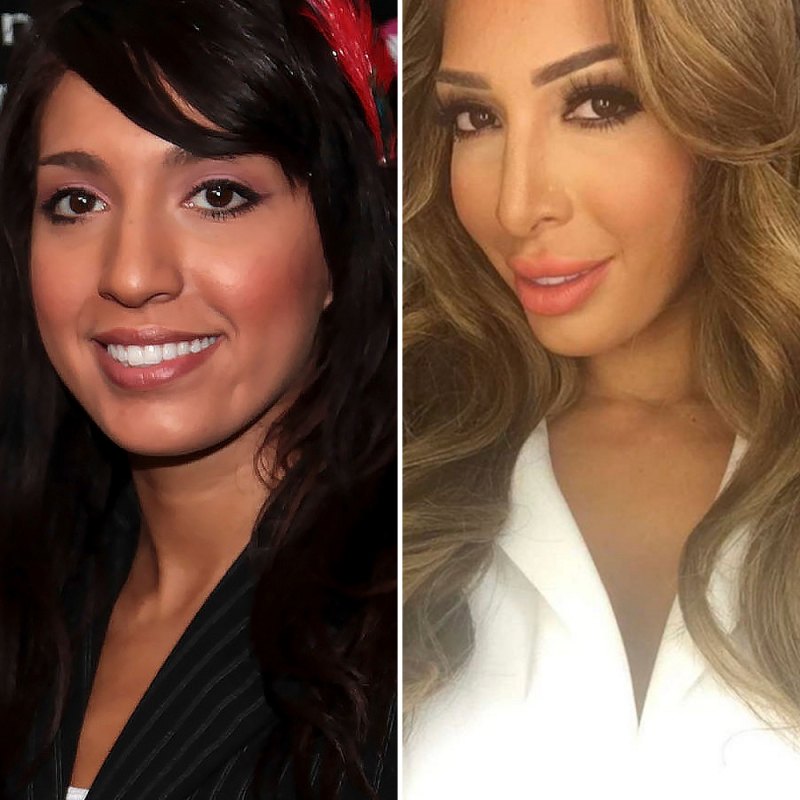 Farrah abraham plastic surgery