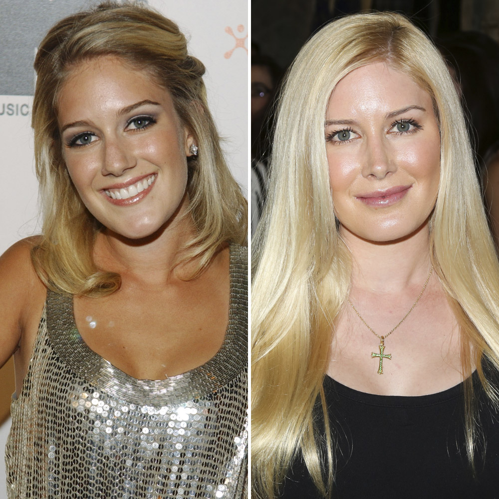 Heidi montag plastic surgery