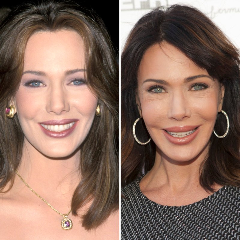 Hunter tylo plastic surgery