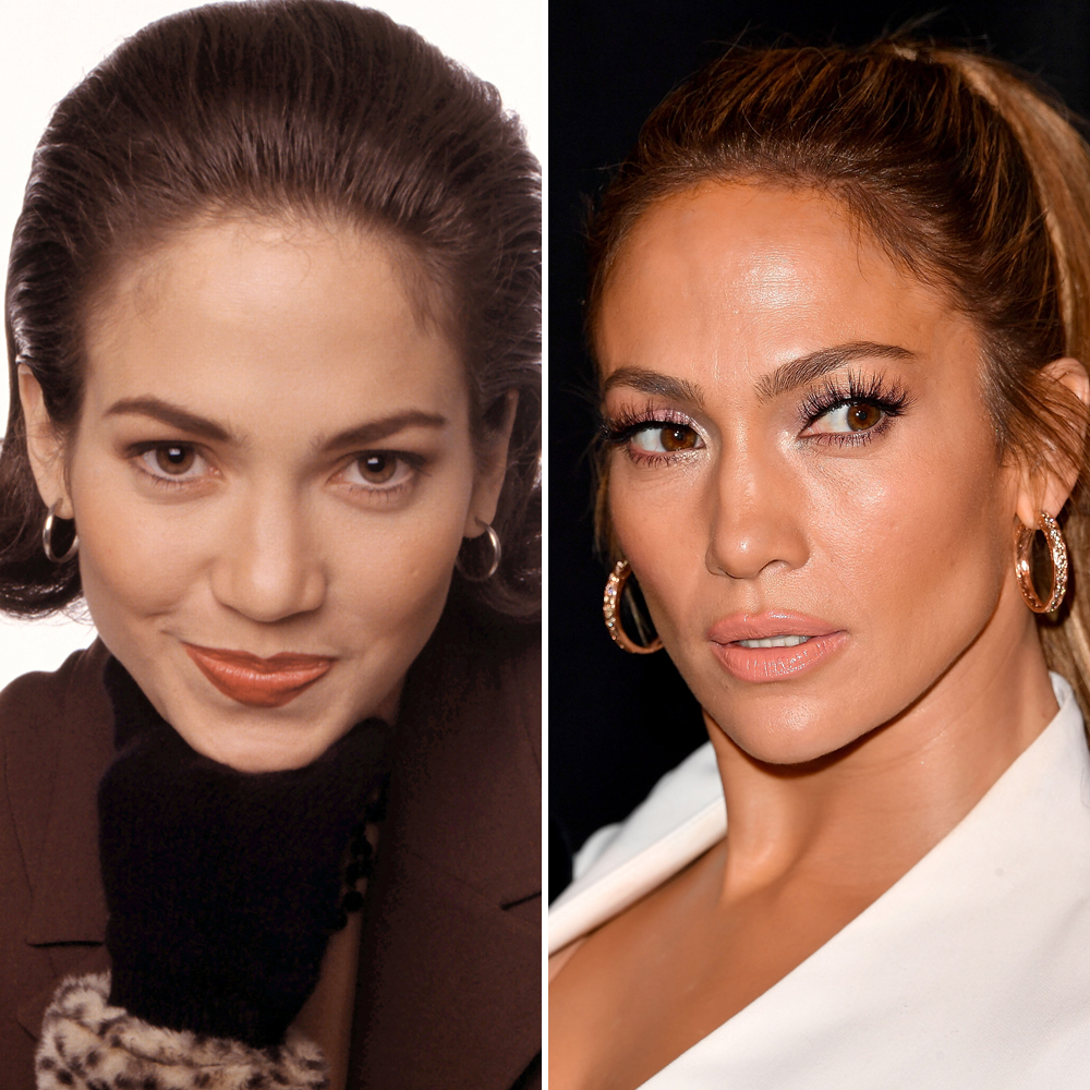 Jennifer lopez nose job