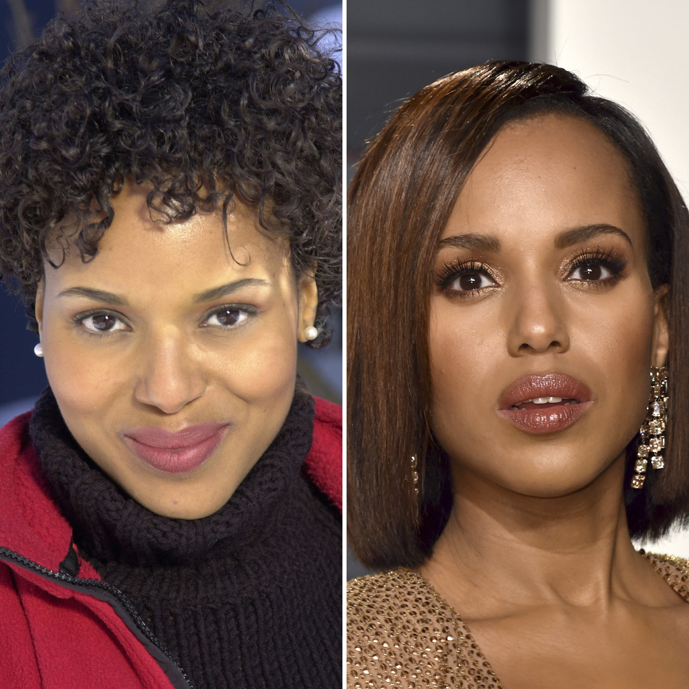 Kerry washington nose job