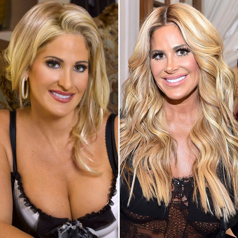 Kim zolciak plastic surgery