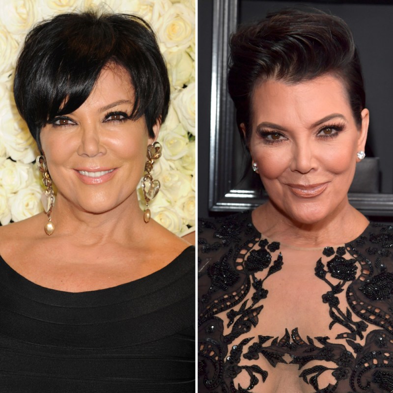 Celebrity Facelifts And Plastic Surgery See Then and Now Pics celebrity-facelifts-and-plastic-surgery-see-then-and-now-pics