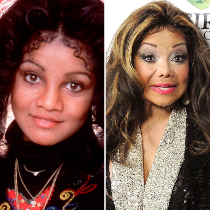 Latoya jackson plastic surgery