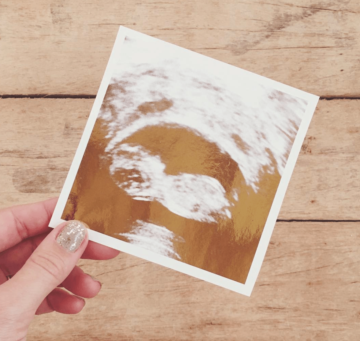 Lauren conrad pregnancy announcement