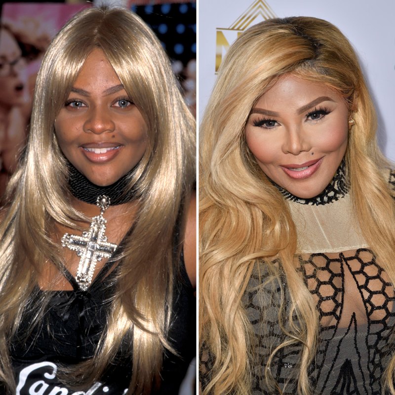 Lil kim plastic surgery