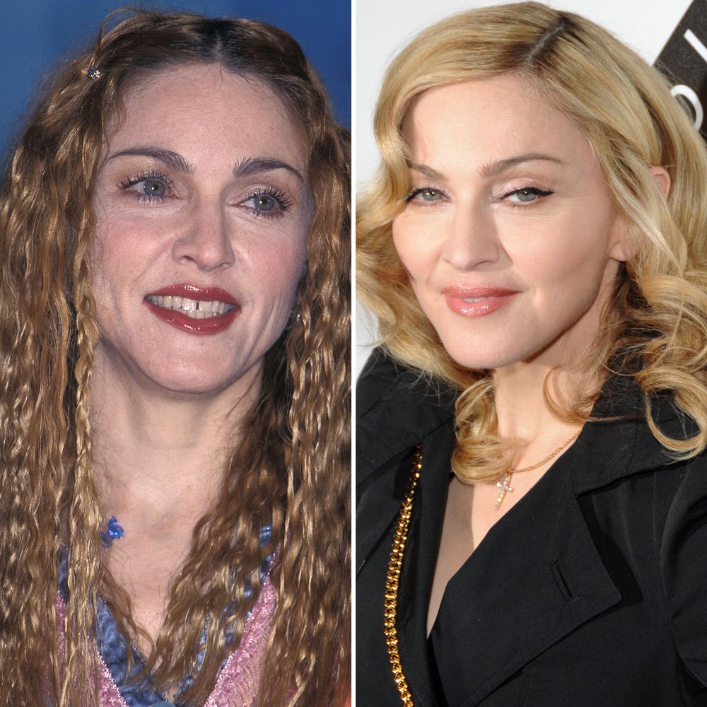 Madonna facelift