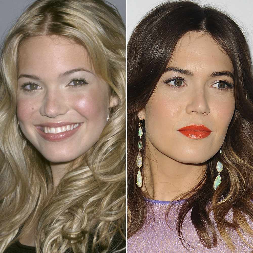 Mandy moore nose job